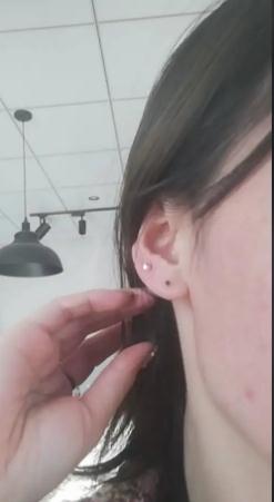 00后女生打耳洞致颅内感染（花一样的青春不易折腾）