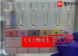 江苏发现2例全球罕见黄金血型（南京免费注册公司方法）